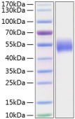 Active Recombinant Human Nectin-1/PVRL1/CD111 Protein (RP01219)