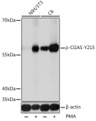 Phospho-CGAS-Y215 Antibody kit (RK05796)