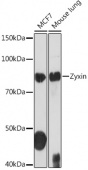 Zyxin Rabbit mAb (A2298)