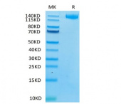 Recombinant Human Leukemia inhibitory factor receptor/LIF-R/CD118 Protein (RP02434)
