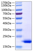 Active Recombinant Human TNF-alpha Protein (RP00993)