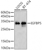 [KO Validated] IGFBP5 Rabbit pAb (A21745)