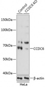 [KO Validated] CCDC6 Rabbit pAb (A19901)