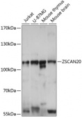 ZSCAN20 Rabbit pAb (A14383)