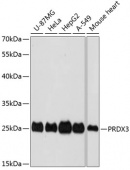 [One Step] PRDX3 antibody Kit (RK05726)