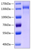 Active Recombinant Human TIE2/TEK/CD202b Protein (RP00122)