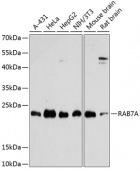 [One Step] RAB7A antibody Kit (RK05740)