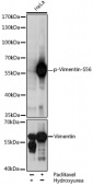 Phospho-Vimentin-S56 Antibody kit (RK06009)