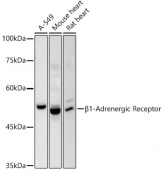 β1-Adrenergic Receptor Rabbit pAb (A20818)