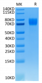 Recombinant Human FLT-2/FGFR1 alpha (IIIc)/CD331 Protein (RP02358)