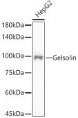 [KD Validated] Gelsolin Rabbit mAb (A22184)