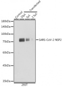 SARS-CoV-2 NSP2 Rabbit pAb (A20280)
