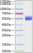 Recombinant Human BMPR-1A/ALK-3 Protein (RP00156)