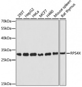 [One Step]RPS4X Antibody Kit (RK05704)