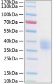 Recombinant Human Endothelial protein C receptor/CD201 Protein (RP01181)