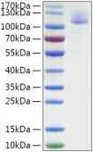 Recombinant SARS-CoV Spike S1 Protein (RP01309)