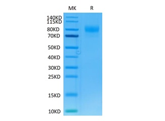 Recombinant Human IL-13RA1/CD213a1 Protein (RP02419)