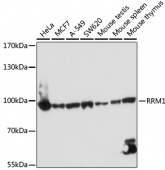 [One Step]RRM1 Antibody Kit (RK05705)