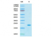 Recombinant Human IL-10 Protein (RP02390)