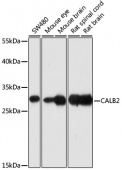 [One Step]CALB2 Antibody Kit (RK05629)