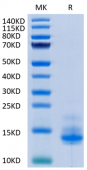 Recombinant Cynomolgus CD3 epsilon/CD3E Protein (RP02214)