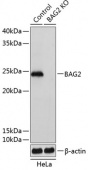 [KO Validated] BAG2 Rabbit pAb (A19945)
