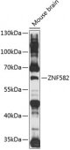 ZNF582 Rabbit pAb (A14453)