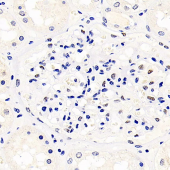 GB11382 Anti -Wilms Tumor Protein Rabbit pAb Antibody