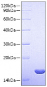 Recombinant Rat FGF-2/bFGF Protein (RP00701)