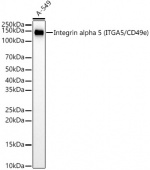 [KD Validated] Integrin alpha 5 (ITGA5/CD49e) Rabbit mAb (A22706)