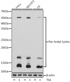 Pan Acetyl-Lysine Rabbit pAb (A2391)