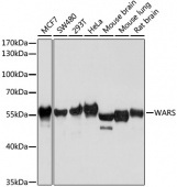 [One Step]WARS Antibody Kit (RK05722)