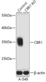 [KO Validated] CBR1 Rabbit pAb (A18074)