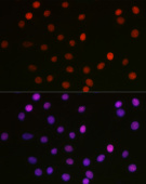 Acetyl-HMGB1-K29 Rabbit pAb (A16002)