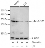 Phospho-Bcl-2-S70 Rabbit pAb (AP0575)