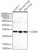 [KO Validated] CDK4 Rabbit mAb (A11136)