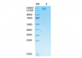 Biotinylated Recombinant SARS-CoV Spike S1 Protein (RP02485)