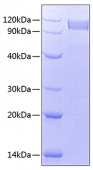 Recombinant Human HGF/Hepatocyte Growth Factor Protein (RP00650)