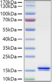Recombinant Human IL-2 Protein (RP01338)