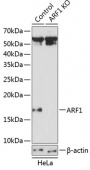 [KO Validated] ARF1 Rabbit pAb (A19977)