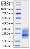 Active Recombinant Mouse CSF-2/GM-CSF Protein (RP01206)