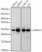 [KD Validated] RAB10 Rabbit mAb (A22746)