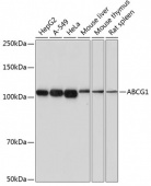 ABCG1 Rabbit mAb (A17907)