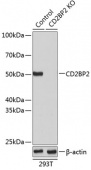[KO Validated] CD2BP2 Rabbit pAb (A19891)