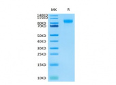 Biotinylated Recombinant Human SELE/E-selectin/CD62E  Protein (RP02351)