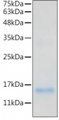 Recombinant Human IL-20 Protein (RP02507)