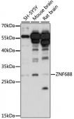 ZNF688 Rabbit pAb (A15568)
