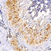 GB11373 Anti -Aggrecan Rabbit pAb Antibody