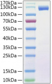 Recombinant Human FLT-3/FLK-2 Protein (RP01314)