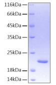 Recombinant Human TNFSF15 Protein (RP00053)